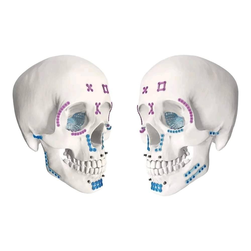 Cranial Kit with Instruments Titanium