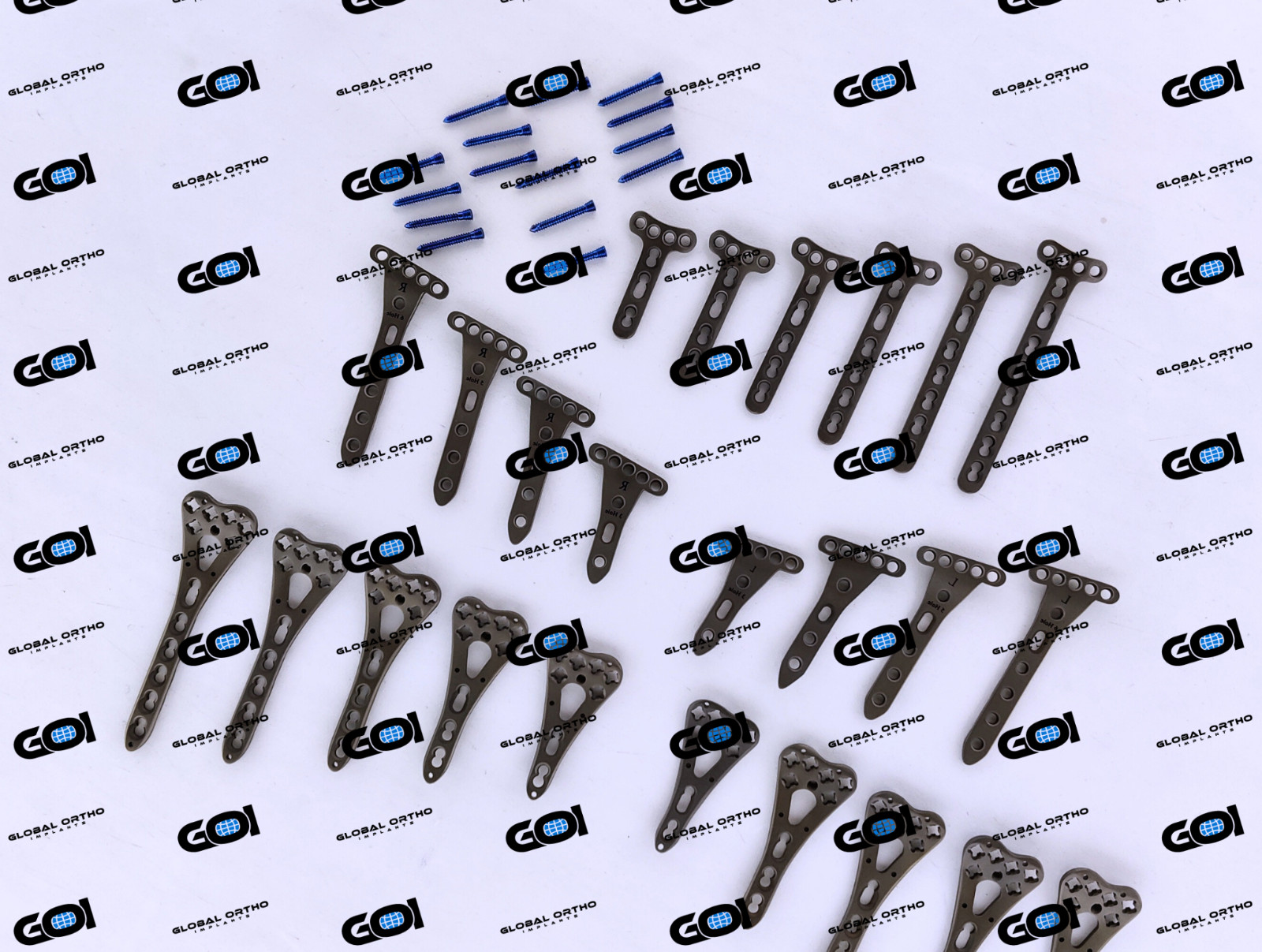 Titanium Locking Plates Set Volar, Extra, Juxta w/ 2.7mm Hex Fasteners 224 Pcs