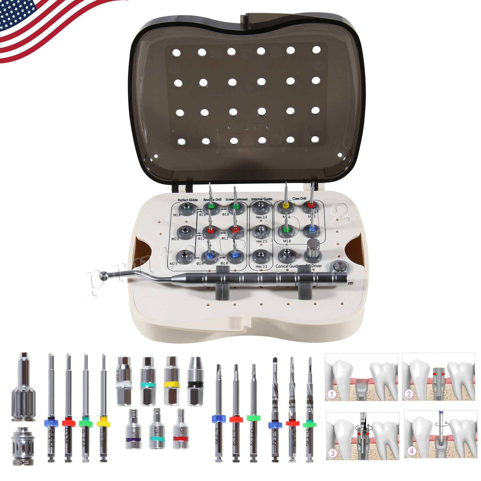 Universal Implant Fractured Broken Screw Removal Kit Surgical Remover NeoBiotech